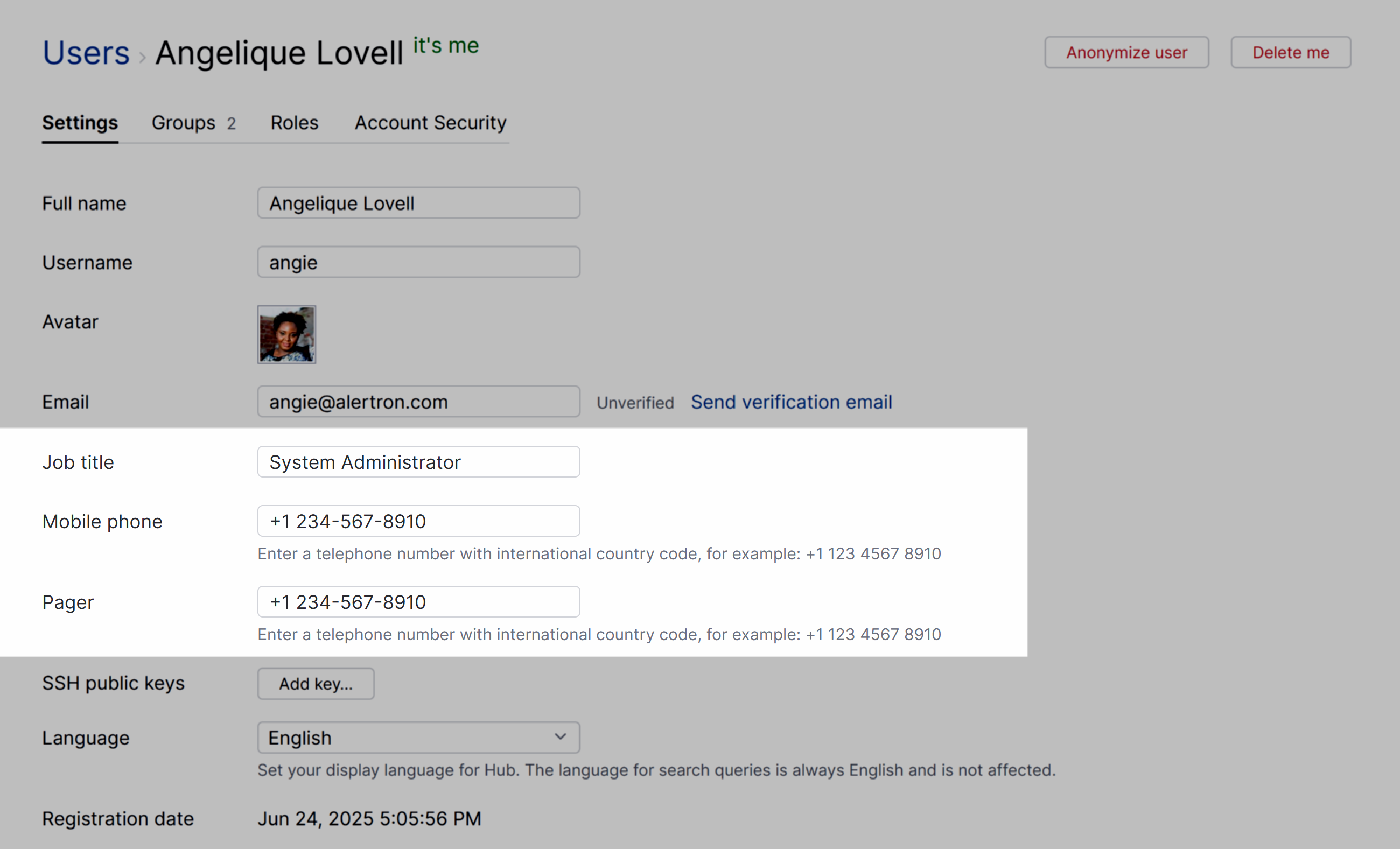 Custom attributes list in a user profile page. Custom attributes list in a user profile page.